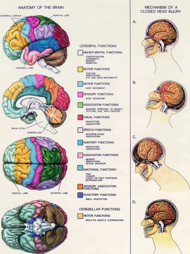 concussion syndrome