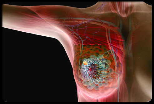 A Tool for Early Breast Cancer Screening