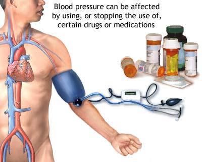 Information on Hypertension