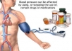 Information on Hypertension