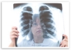 The Malignant Mesothelioma Life Expectancy