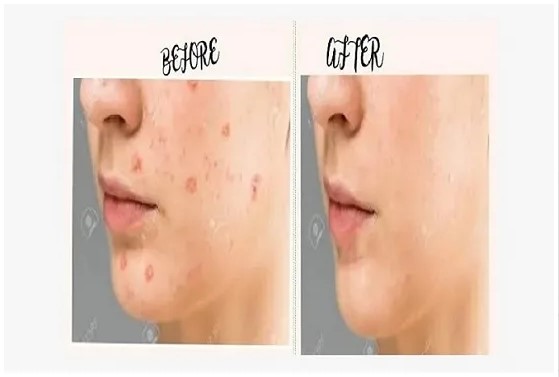 i will retouch and remove background from 20 images professionally 