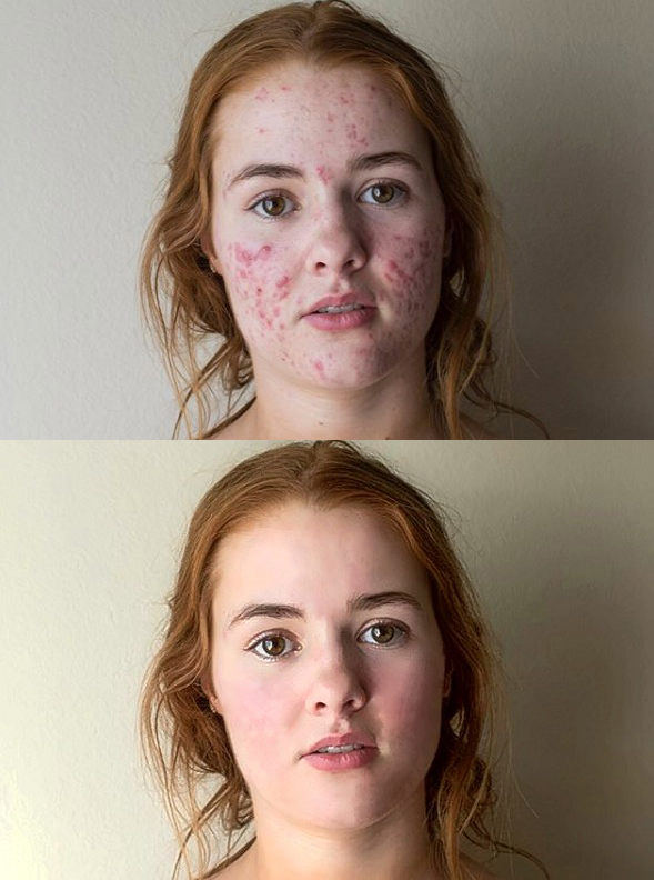 I will do photoshop editing and photo Retouching 5 Photos