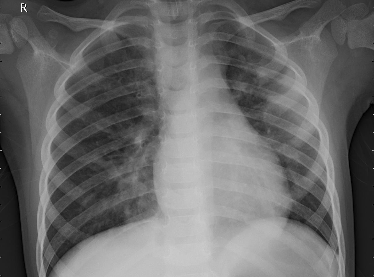 Face deduction artificial intelegence software for we...