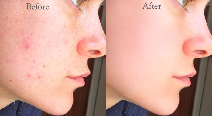 I will do high-end beauty portrait retouching, photo editing with Photoshop