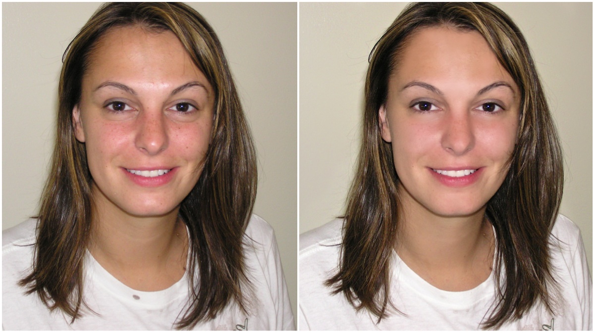 I will remove blemishes and improve skin to three of your photos