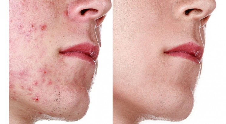 Edit Your Photos On Photoshop