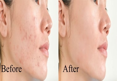 I will do photo editing and skin retouching within 24 hours