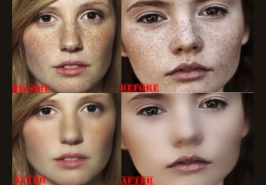 I will remove spots on your face within 2 hr