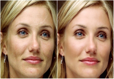 I will remove blemishes and improve skin to three of your photos